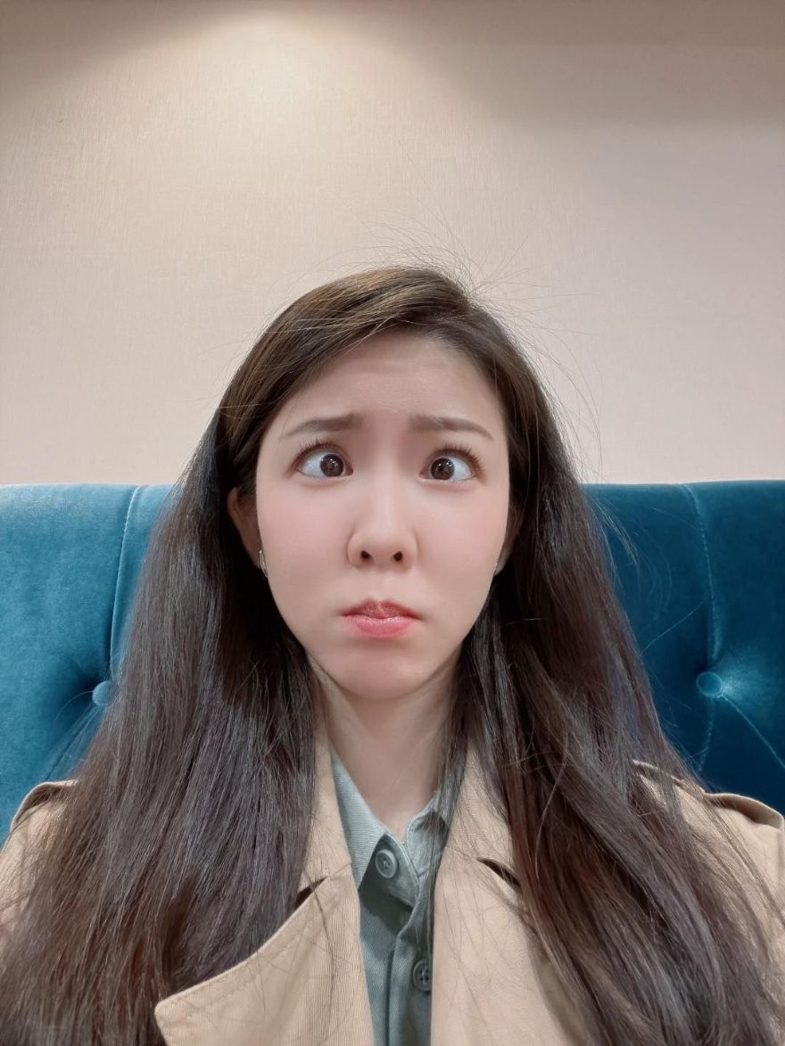 肉毒抬頭紋讓額頭透亮平整，好好維持外在年紀，細紋一定要立刻消滅