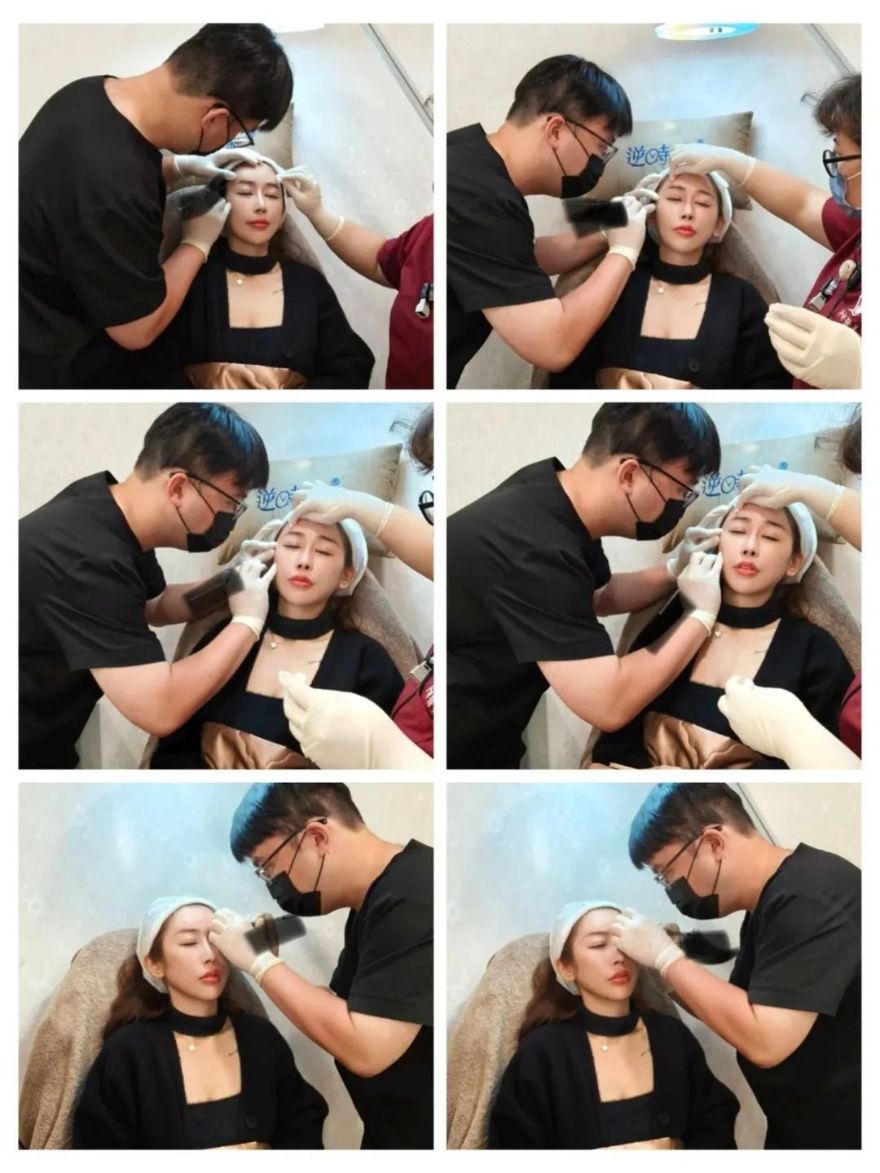 線條飽滿、側面完美弧度！交給淨妍醫美專業醫師評估，打造韓系柔美額頭