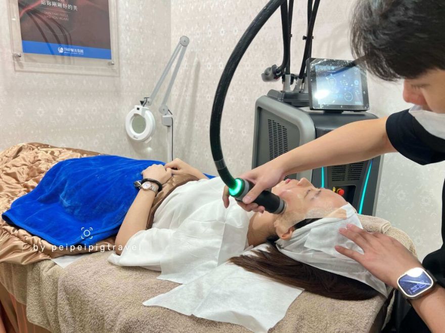 新竹醫美推薦|三次Onda Pro 超微波完整療程全紀錄-美麗輪廓線,拍照零死角