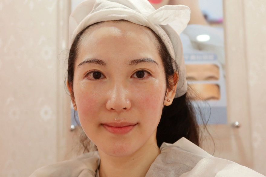 ONDA Pro 超微波|低疼痛感的肉肉臉剋星!