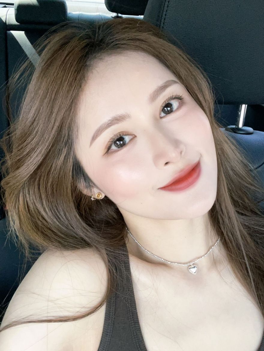 王笑笑_淨妍醫美逆時針案例分享