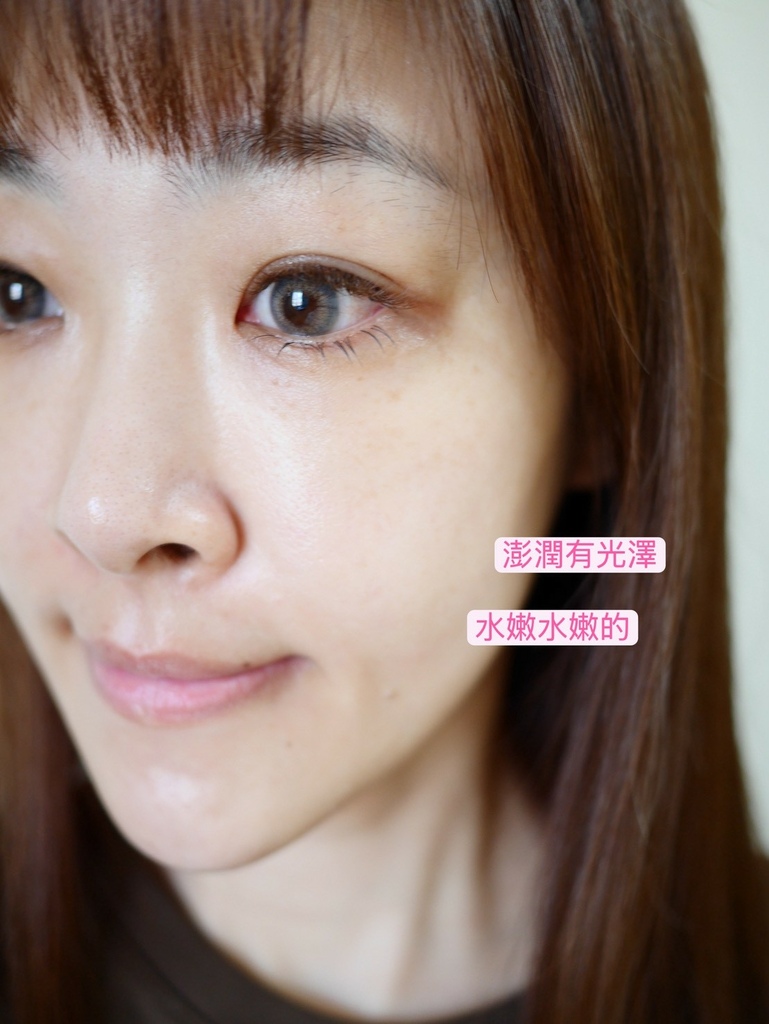 靠液態電波逆轉肌膚生命力_Profhilo逆時針