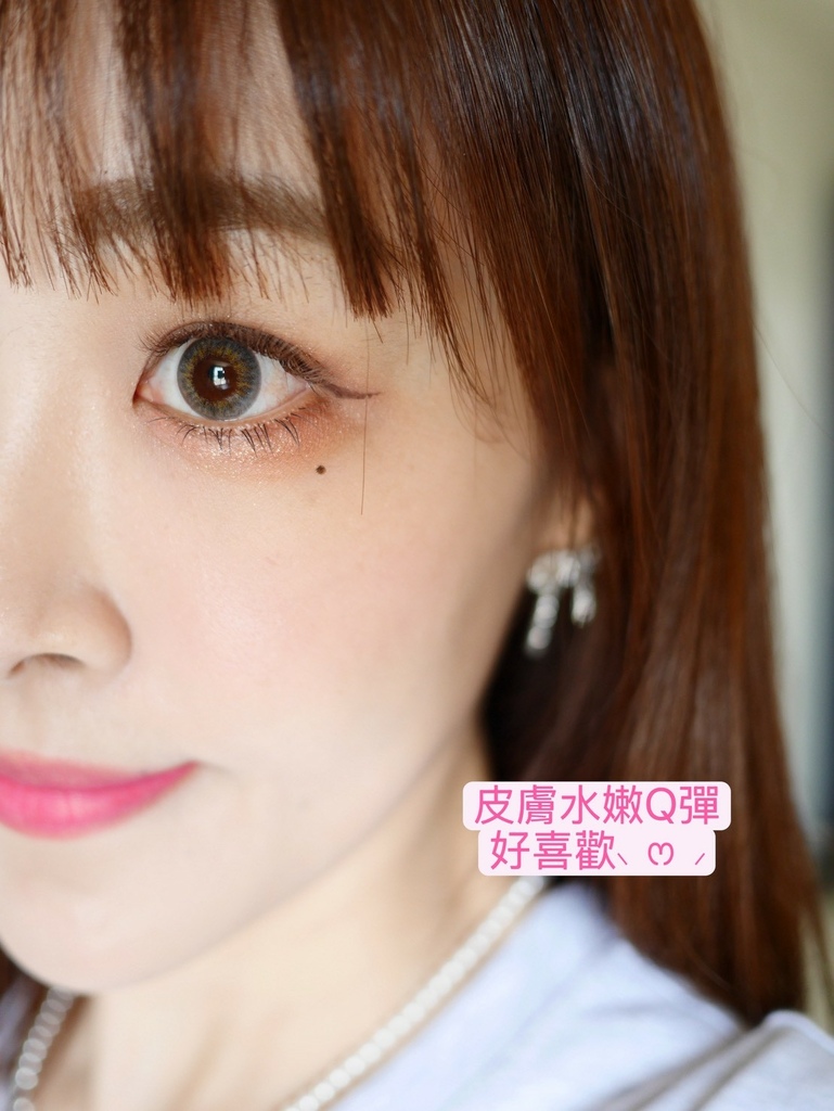 靠液態電波逆轉肌膚生命力_Profhilo逆時針