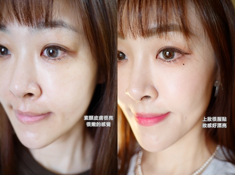 靠液態電波逆轉肌膚生命力_Profhilo逆時針