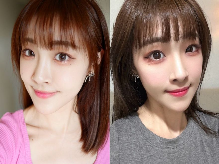 靠液態電波逆轉肌膚生命力_Profhilo逆時針