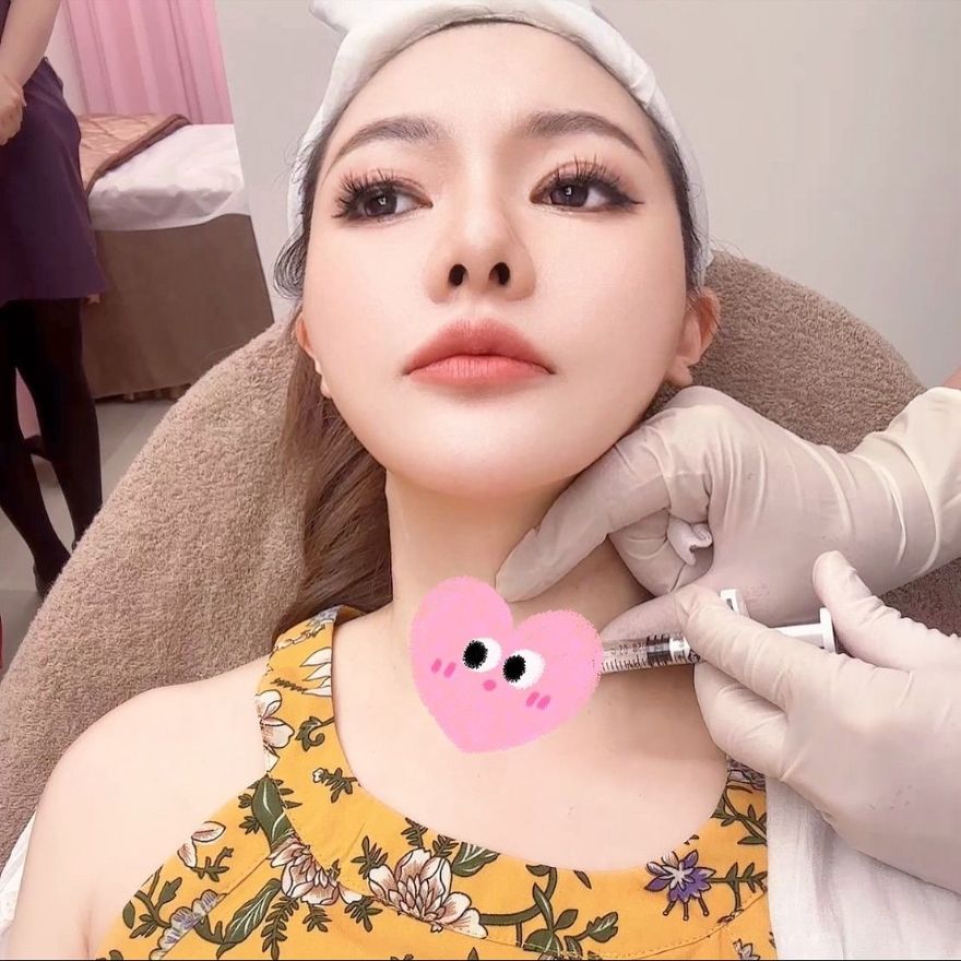 低頭族的困擾、脖子逐漸長出紋路，Profhilo逆時針不僅可深層保濕，還能提升肌膚緊緻度