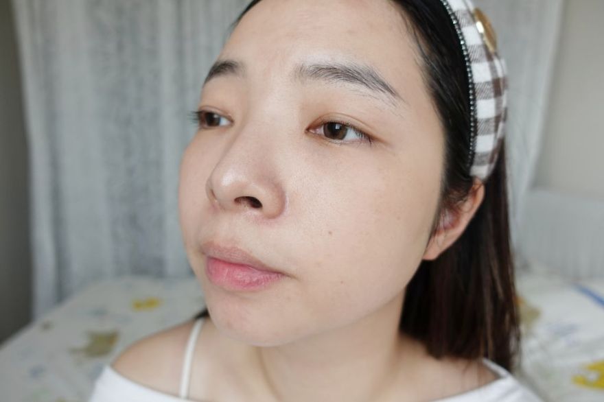 「皮秒雷射+Rejuran麗珠蘭」台北醫美推薦，出國拍照必備保養，細緻肌膚毫無死角！