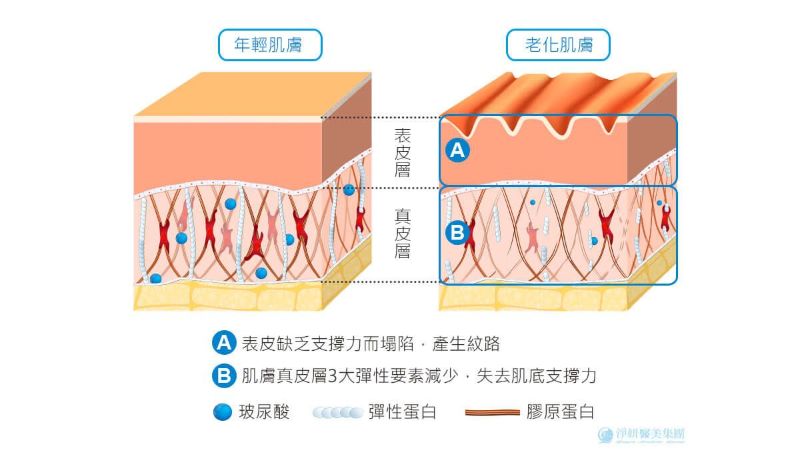 第52屆淨妍學院《絲登齡玻尿酸注射經驗與技巧分享》