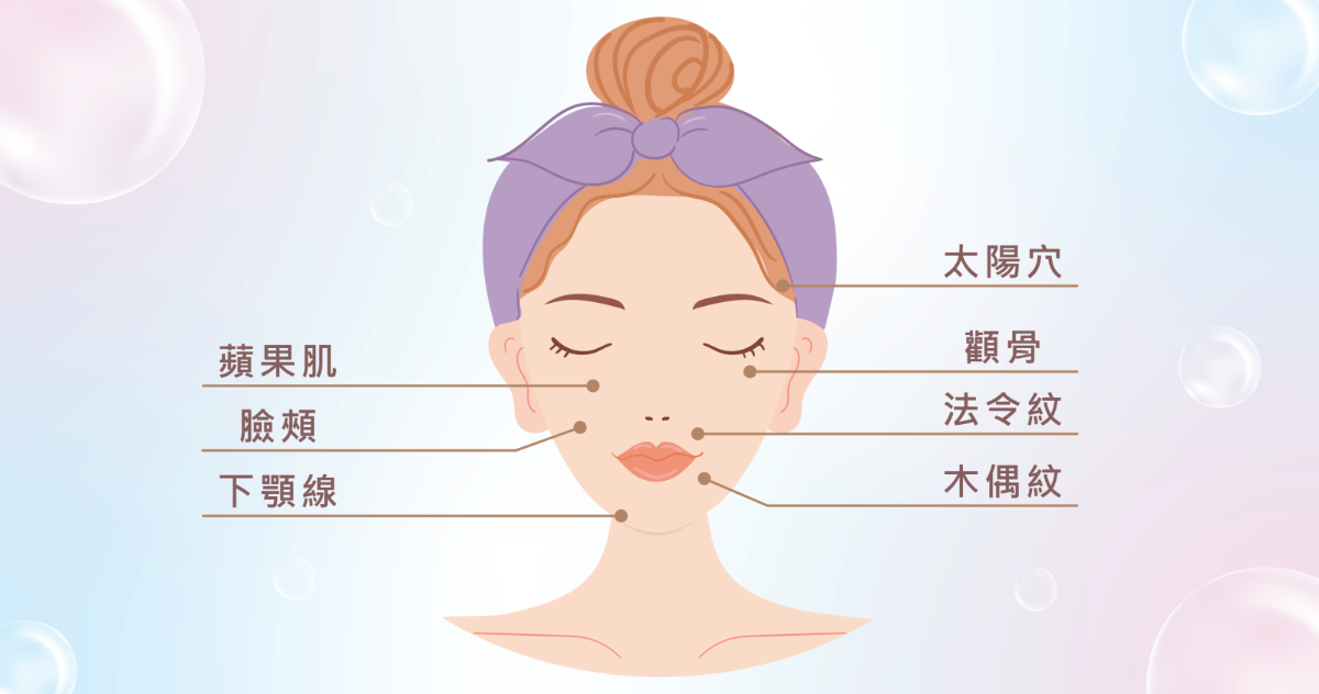 曙光瓶aesPlla適合注射在真皮層，改善臉部紋路及填補凹陷