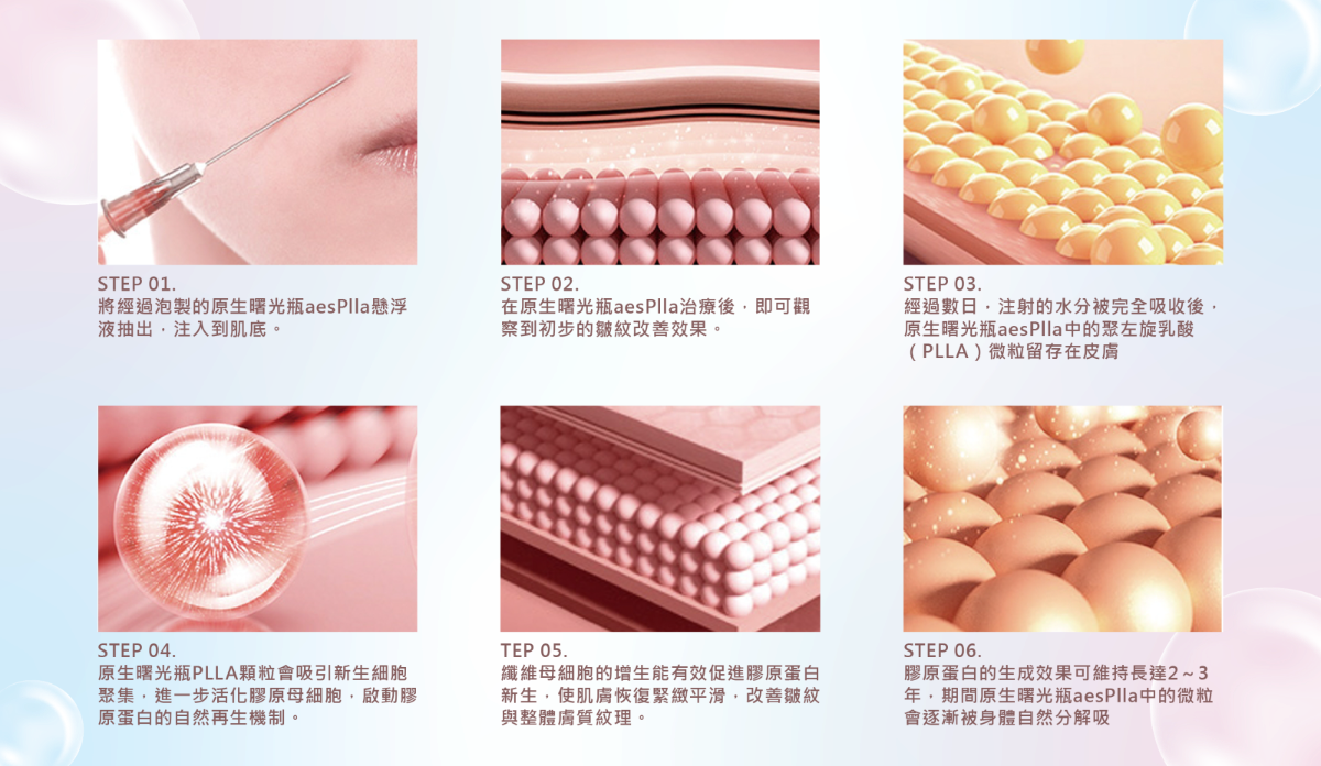 曙光瓶aesPlla適合注射在真皮層，改善臉部紋路及填補凹陷