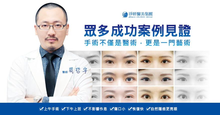 周哲宇醫師擅長打造自然雙眼皮，淨妍醫美雙眼皮手術成功案例
