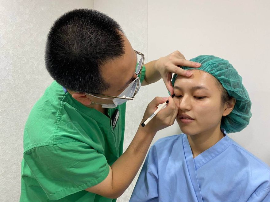 縫雙眼皮手術前畫線溝通理想眼型