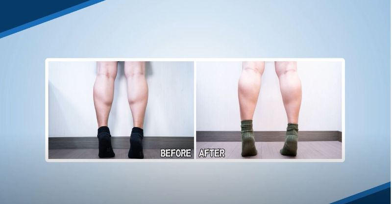 消防員阿芷肉毒小腿全紀錄，真實見證改善小腿肌發達的問題！