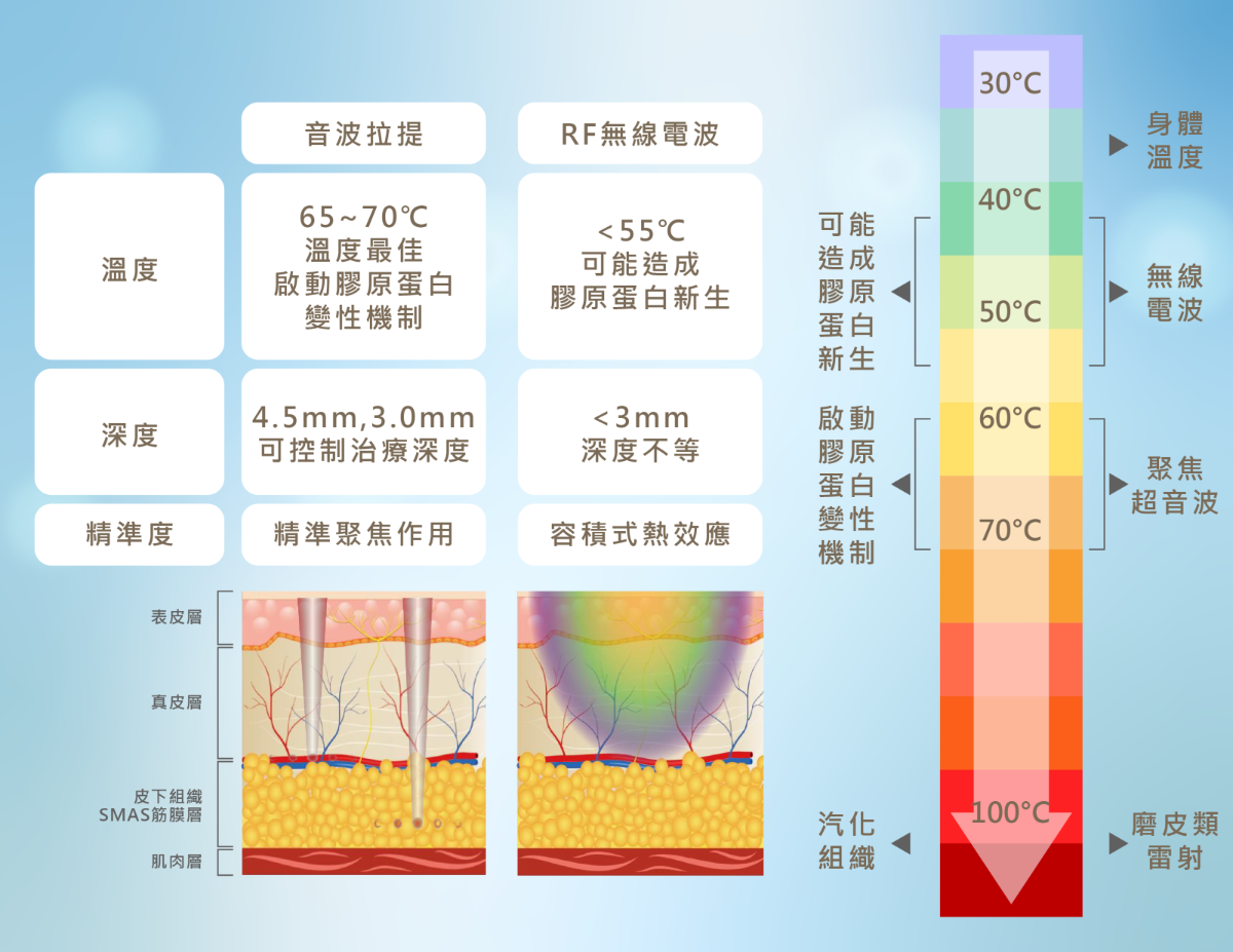 LiftSonic麗芙音波Ⅲ 與無線電波、超音波、雷射有什麼不同？