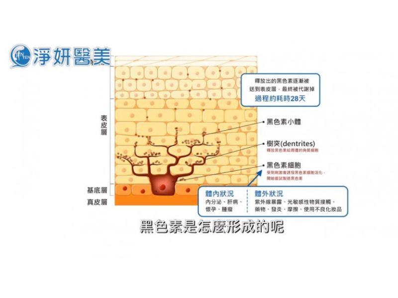 黑色素