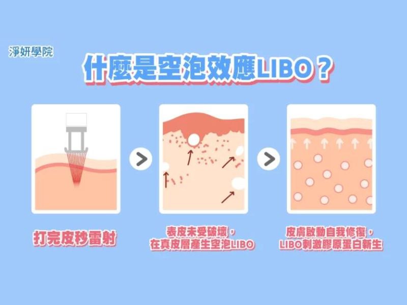 什麼是空泡效應LIBO