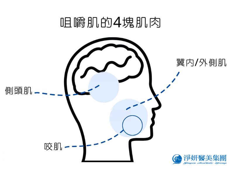 咀嚼肌是由4塊肌肉側頭肌、咬肌、翼內和翼外側肌所組成