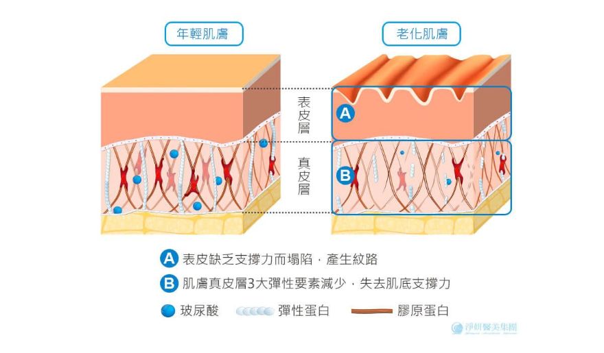 玻尿酸和膠原蛋白則會隨著年齡逐漸流失，出現鬆、垮、垂、凹等肌膚問題