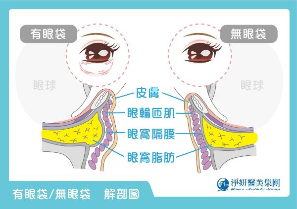 眼袋構造