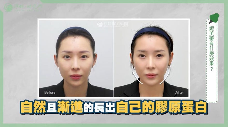 紫外線竟會破壞膠原蛋白！醫示三大補充方式