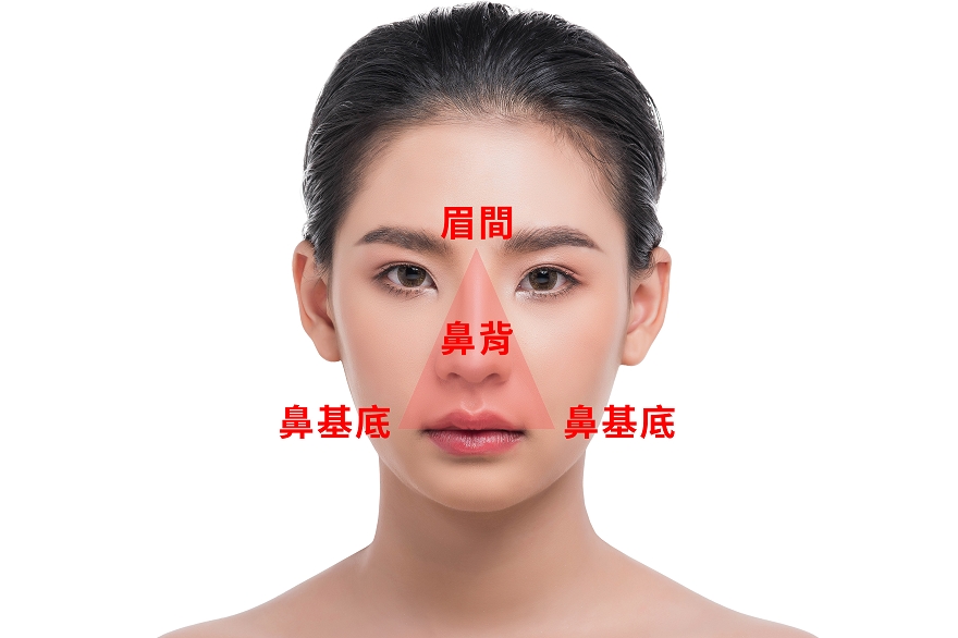 臉部某些部位是「高風險區」，施作不當可能導致導致血管栓塞、皮膚壞死，甚至視覺永久喪失。