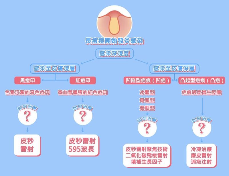 痘疤種類與除痘疤的方法說明圖