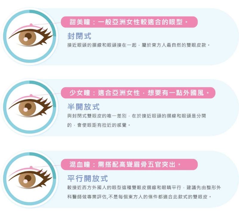 雙眼皮手術類型分為開放式、封閉式、半開放式