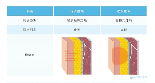 電波拉皮與音波拉皮差異