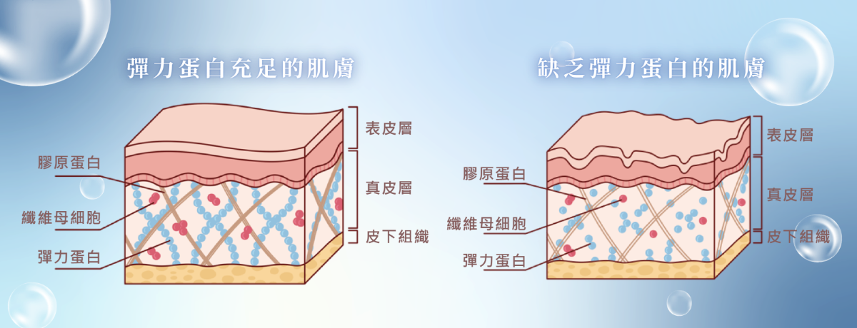 Profhilo逆時真（璞菲洛高低分子玻尿酸皮下植入劑）可以明顯改善肌膚老化鬆弛及粗糙乾燥的問題，是一種全新提升肌膚的治療方式，可以使肌膚緊緻有彈力、毛孔細緻、輪廓緊緻，強化肌膚屏障，從根本重塑肌底健康，減少泛紅、粗糙及敏感問題。