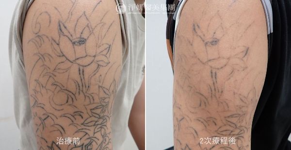 刺青上手臂BA