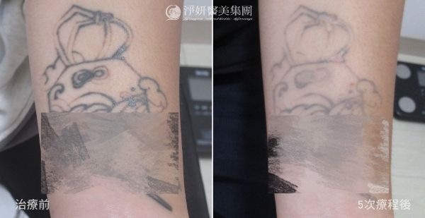 刺青下手臂BA