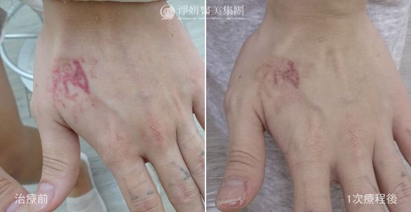 刺青手背BA