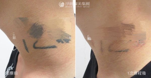 刺青側頸BA