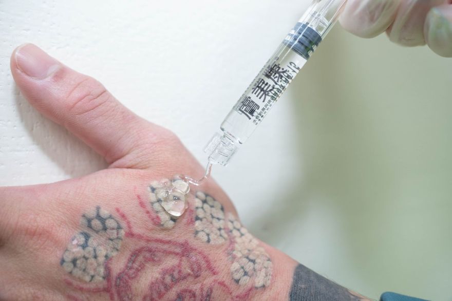 淨妍醫美除了提供專業雷射治療，也同步安排完整衛教說明與術後照護，並與校方師長及輔導人員合作，從生理到心理層面提供支持，讓學生能在安全、穩定的環境中接受療程。