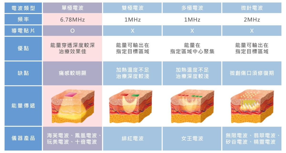單極電波市面上除了海芙電波外，還有鳳凰電波、玩美電波及十蓓電波。