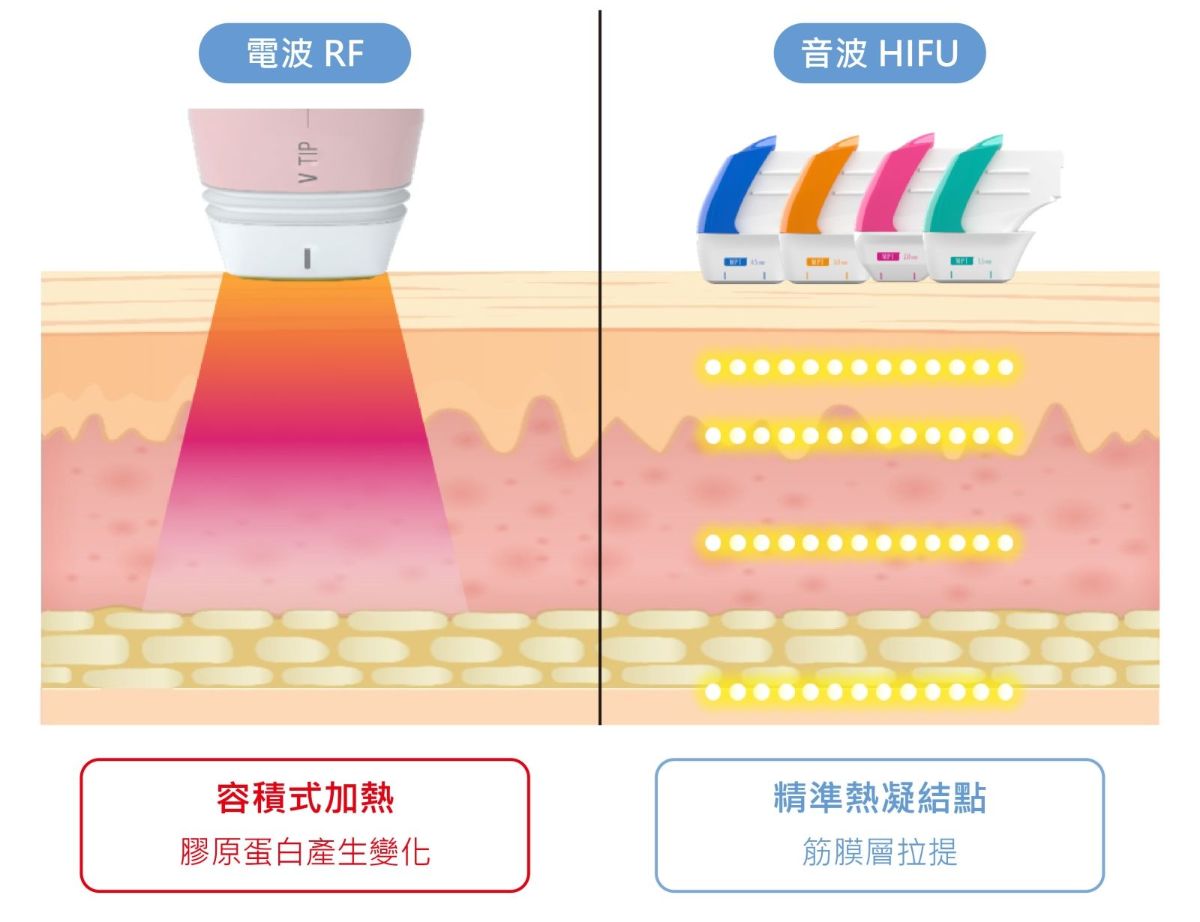 海芙電音雙波，合併治療，效果加倍