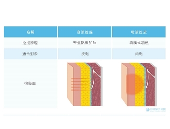 電波拉皮VS.音波拉皮 該選哪個？三十秒快速自我評估