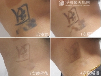 叛逆到簽志願役 人生的重啟鍵