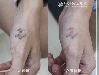 從青澀到重生 用心守護改變的勇氣