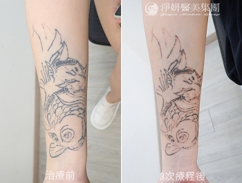 14歲留下的印記　學會為人生重新選擇